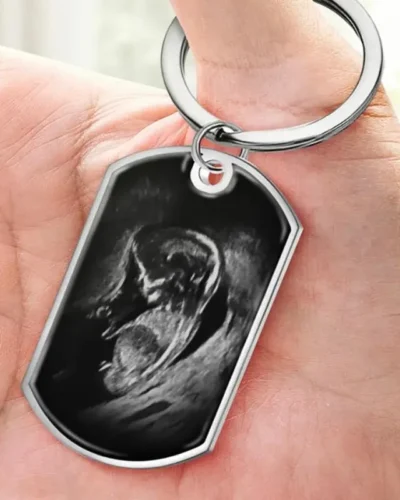 Personalized Baby Ultrasound Photo Keychain